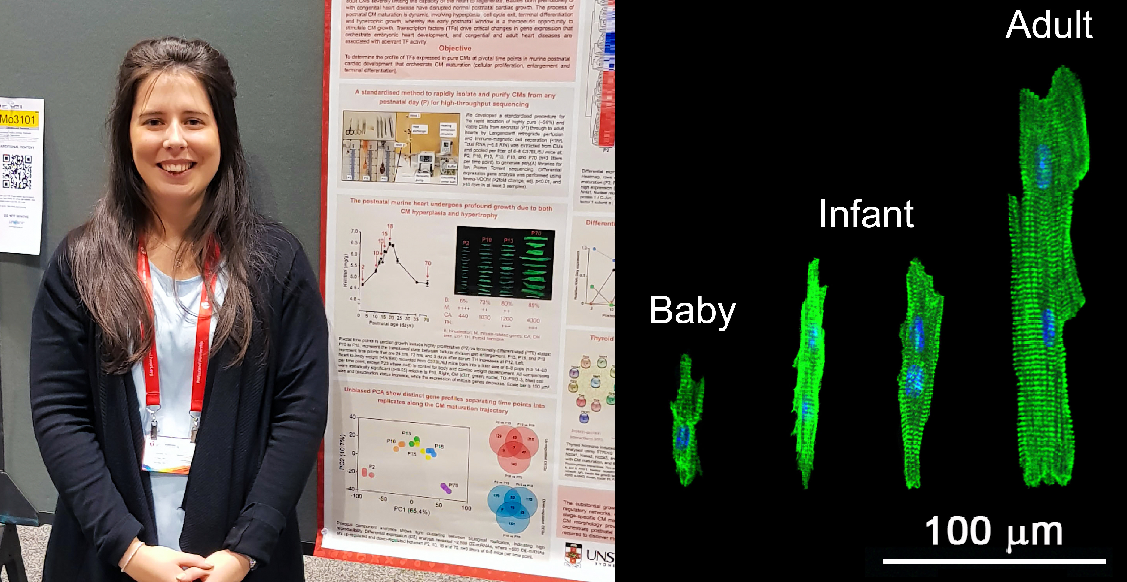 Dr Amy Nicks standing beside her research poster for AHA; Image of cardiomyocytes P2, 10, 13, and adult with labels.