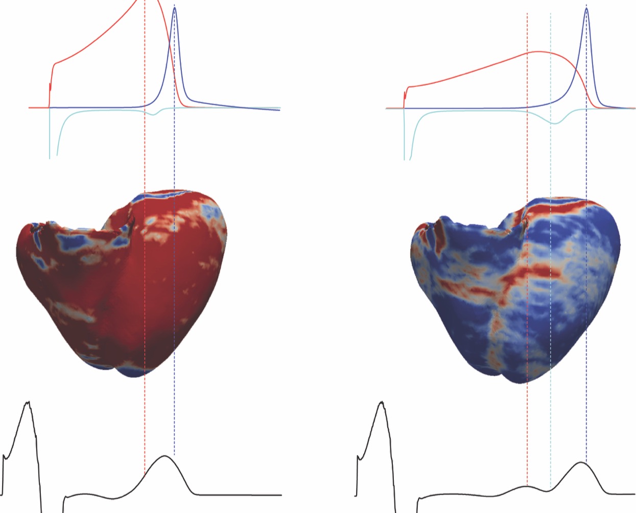 Australian Heart Disease Research - Victor Chang Cardiac Research Institute