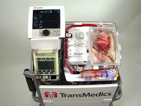 Heart Transplant Research Breakthrough